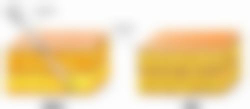 三、腰腹吸脂的其他潜在危害