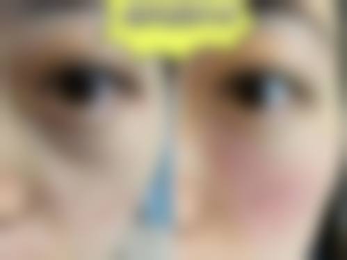 二、韩国Vitchaewoon皮肤科怎么样？
