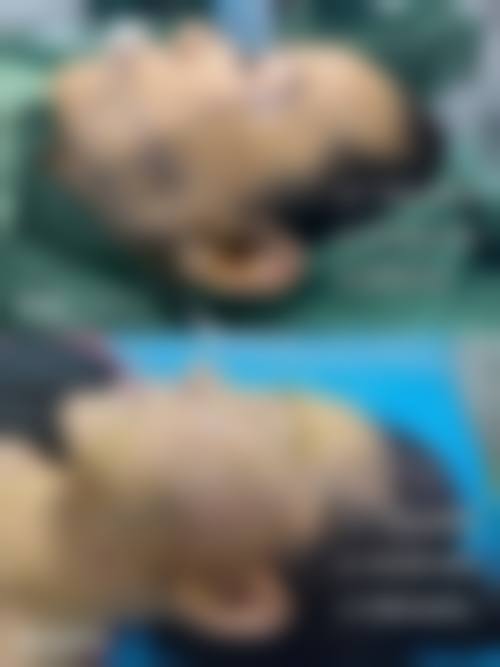 五、韩国Vitchaewoon皮肤科价格表