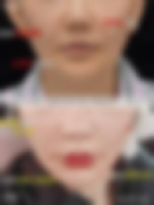 三、韩国Vitchaewoon皮肤科诊疗项目有哪些？