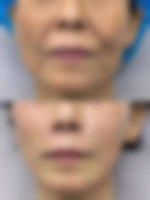 六、韩国Vitchaewoon皮肤科地址及交通