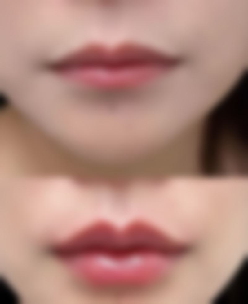 九、北京科发源医疗美容植发医院真实的患者评价