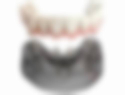 肋软骨隆鼻有什么风险和后遗症？了解危害提前规避，让隆鼻更安心！ 