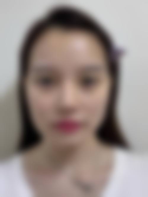 二、广东深圳华晟时代整形医院怎么样？