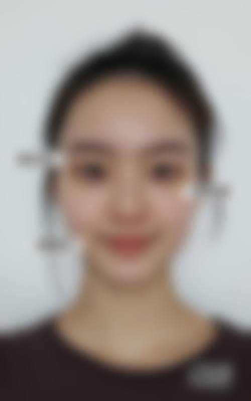 八、京都站前雅美容外科真实的患者评价