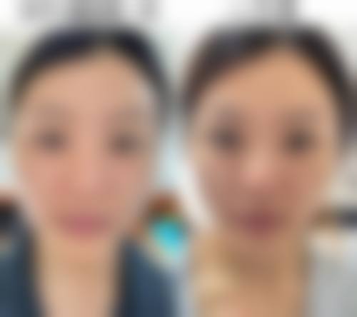 四、吕如松收费价格表