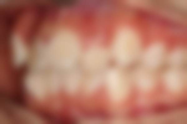 九、广东深圳华晟时代整形医院真实的患者评价