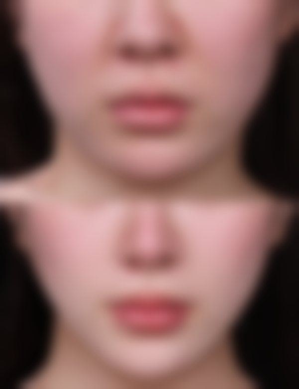 五、吕如松怎么预约？