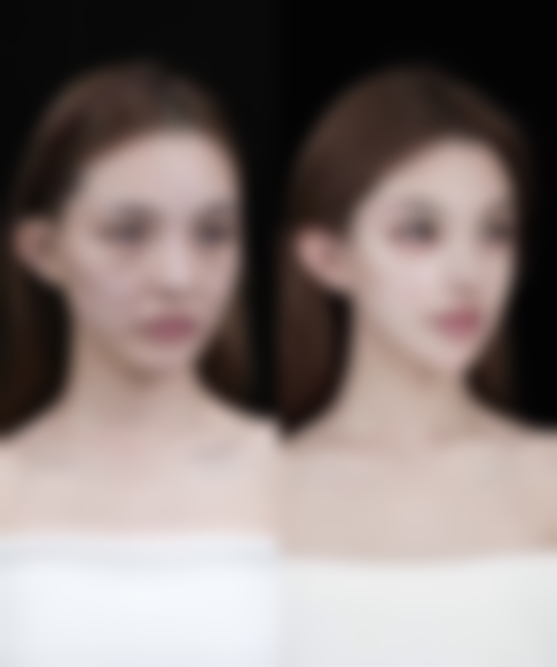 四、疤痕早期干预小妙招