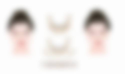 三、影响割眼袋内切修复时间的因素