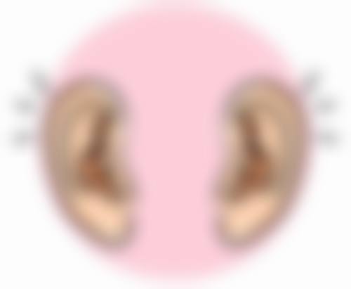 四、关于假体更换的误区