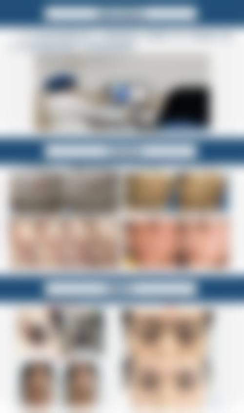 八、杭州艾恒美医疗美容诊所预约方式