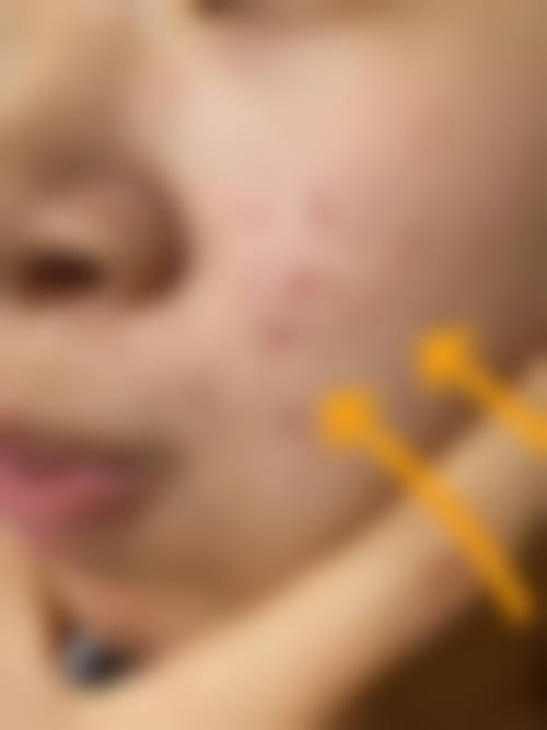 八、益阳格莱美整形美容门诊部预约方式