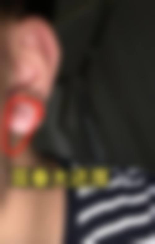 八、北京卓颜蕊丽整形医疗美容（原知音蕊丽）真实的患者评价