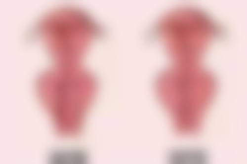 二、做全切双眼皮消肿时间的基本情况