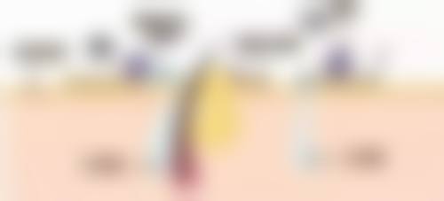 三、刘衍民技术优势