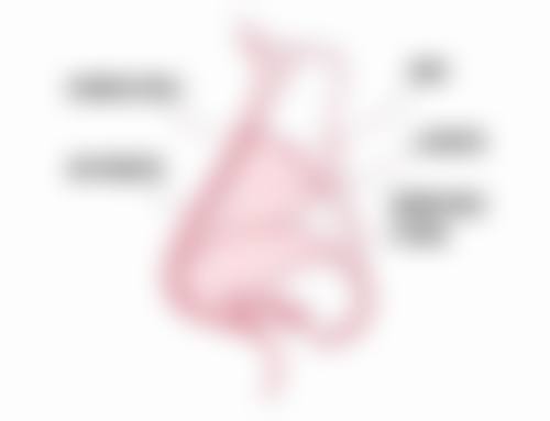 三、去增生疤痕怎么办？局部注射有妙招