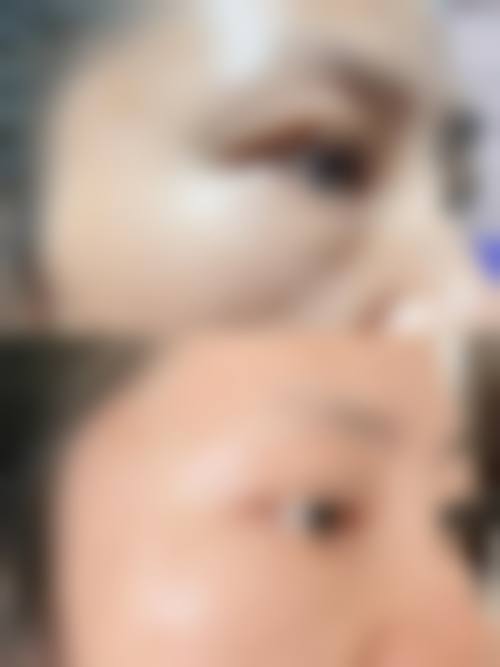 八、太原宝格丽美医疗美容诊所真实的患者评价