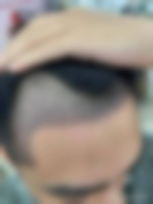 八、爱她ATOP整形外科真实的患者评价