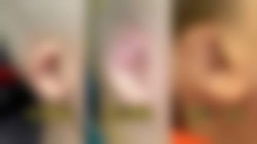 九、太原柏芙美整形医院真实的患者评价