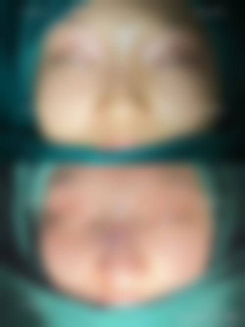 四、太原柏芙美整形医院特色项目