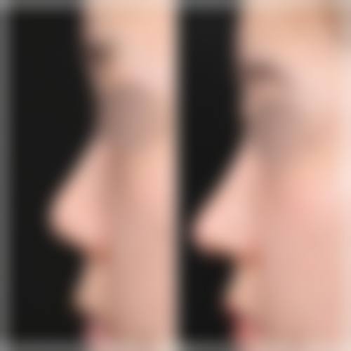 三、曾思技术优势