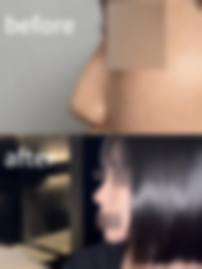 七、河南三门峡常亮整形美容中 心预约方式