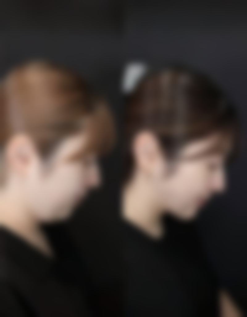 六、去增生疤痕怎么办？日常护理不能忘