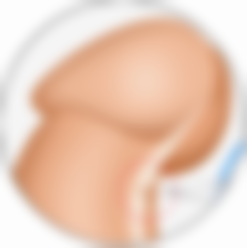 三、选择治疗方法的注意事项