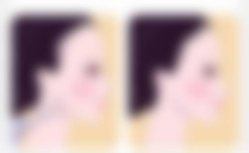 五、粉毒除皱可能出现的风险和应对措施