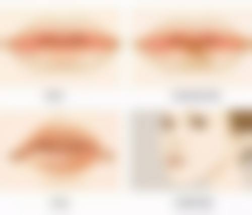 二、重庆三峡医药高等专科学校第二附属医院整形外科怎么样？