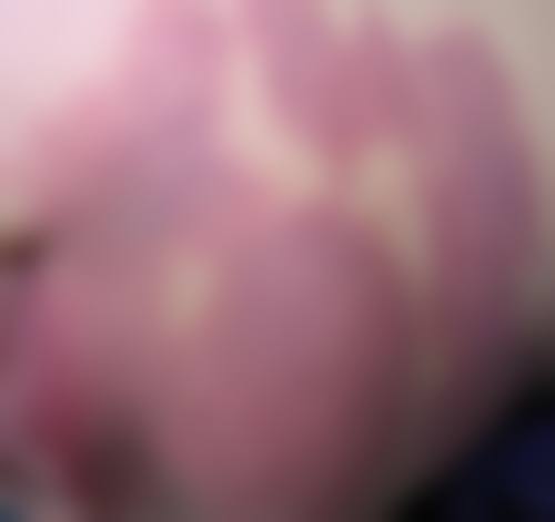 四、保定普济医疗美容诊所特色项目