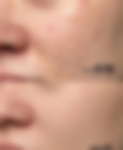 四、重庆三峡医药高等专科学校第二附属医院整形外科特色项目