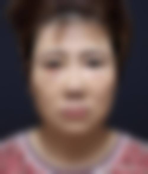 四、西安莲湖瑞丽医院医学美容特色项目