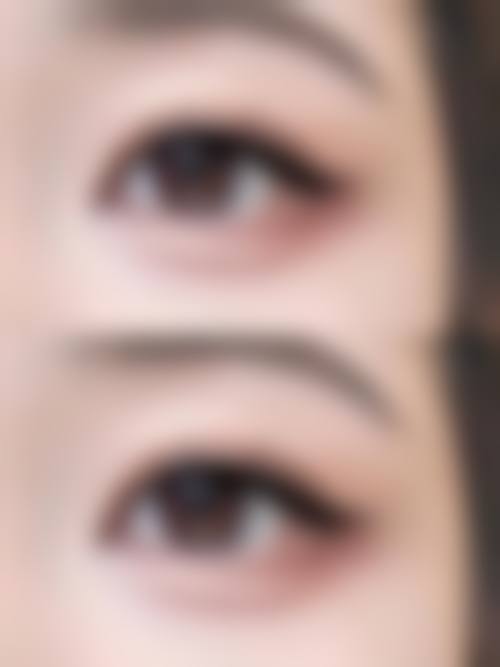 五、嘉兴嘉华整形美容医院价格表