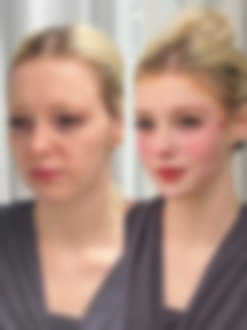 二、巴婷美疤痕修复中 心怎么样之修复项目