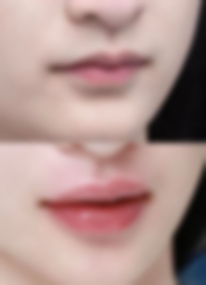 巴婷美疤痕修复中 心怎么样？真实成效大揭秘，给你修复疤痕的新希望！