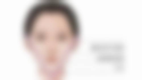 五、抽脂丰胸对身体有害吗之实例分析