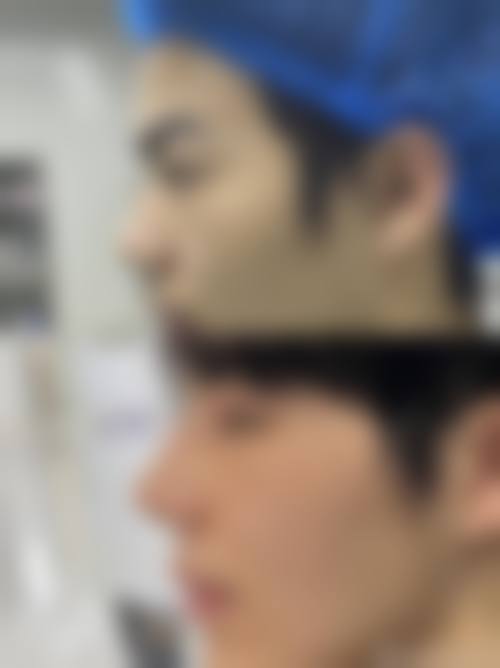 八、南京鼻祖眼鼻整形医院预约方式