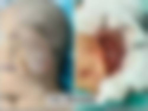 八、广州雅和整形医疗美容门诊预约方式