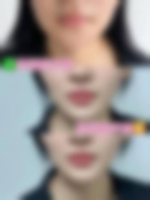 六、广州雅和整形医疗美容门诊价格表