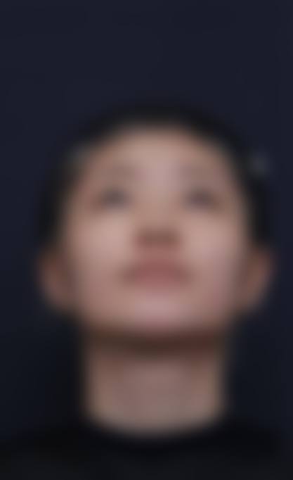 三、南京鼻祖眼鼻整形医院诊疗项目有哪些？