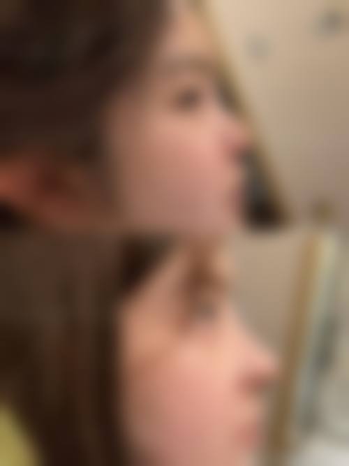 八、黄冈美伊尔整形美容门诊部真实的患者评价