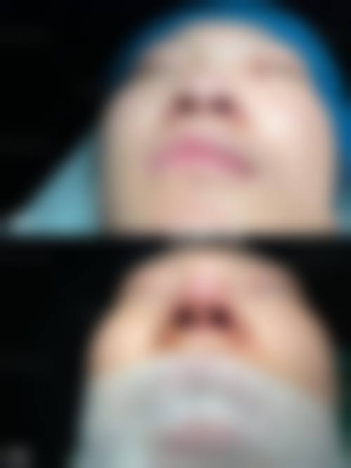 二、南京鼻祖眼鼻整形医院怎么样？