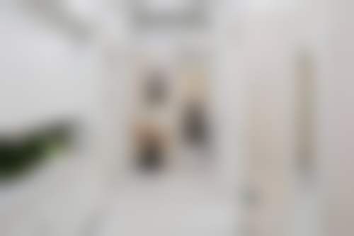 一、怎样去除眼袋之了解眼袋形成的原因