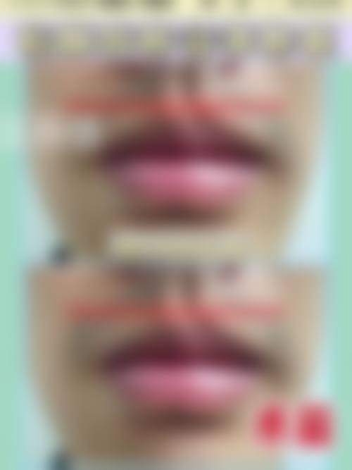 八、天津莉菲儿整形医疗美容诊所真实的患者评价