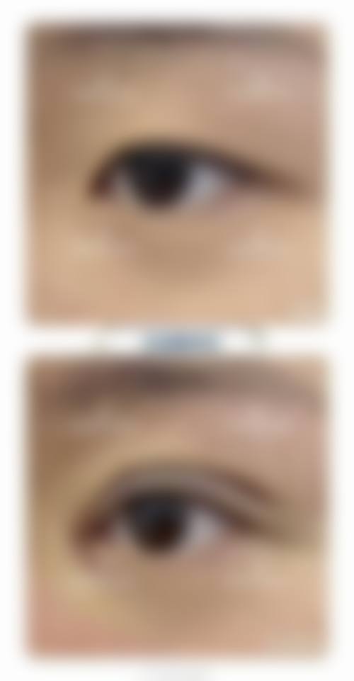 三、朴寿根技术优势