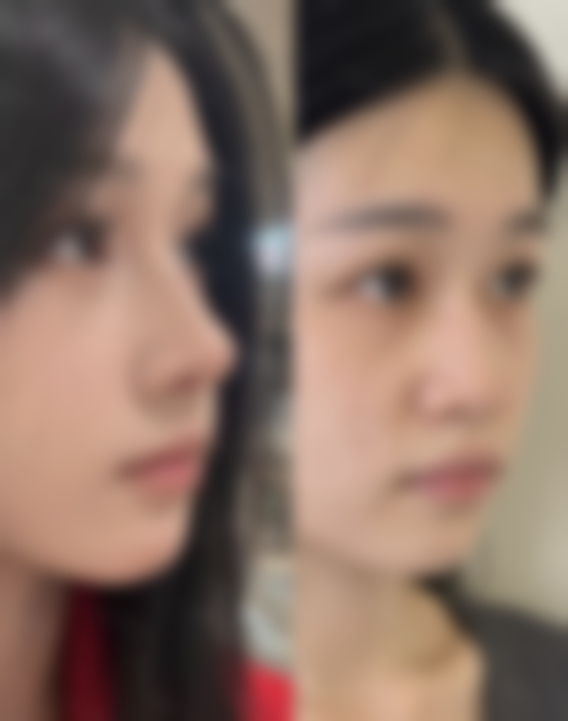 二、怎样才能去掉疤痕增生呢？药物治疗法