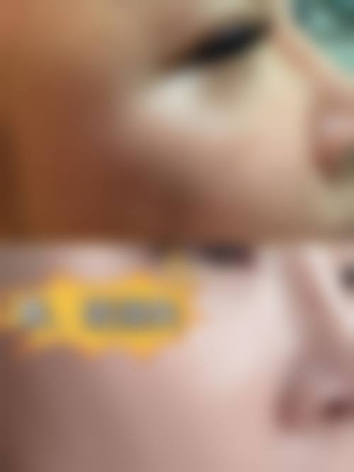 四、克拉玛依新颐美医疗美容诊所特色项目