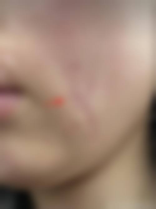 六、songin - gook真实的患者评价